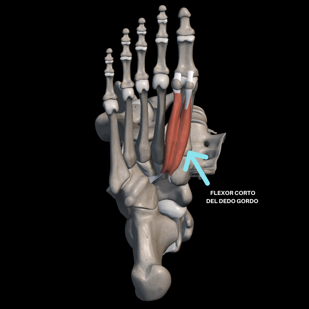 Tratamiento con flossing del dolor en el pie (sesamoiditis)